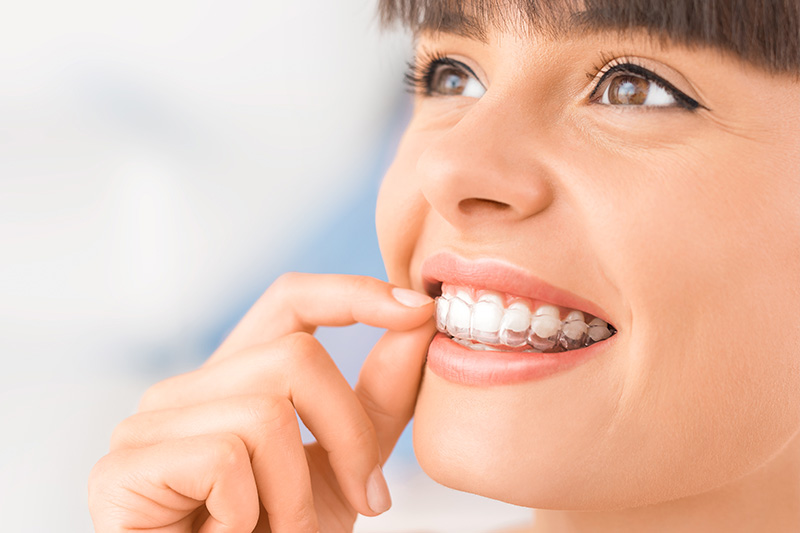 Invisalign in El Paso